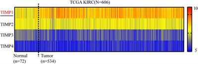 TIMP1 Indicates Poor Prognosis of Renal Cell Carcinoma and Accelerates Tumorigenesis via EMT Signaling Pathway